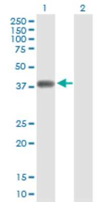 Western Blot: NKD2 Antibody [H00085409-D01P]