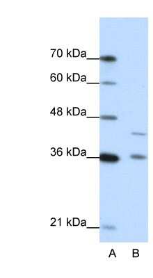 Western Blot: NKD2 Antibody [NBP1-54733]