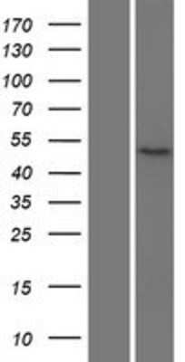 Western Blot: NKD2 Overexpression Lysate [NBP2-05917]