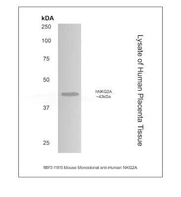 Western Blot: NKG2A/CD159a/KLRC1 Antibody (MM0487-8S36)Azide and BSA Free [NBP2-11815]