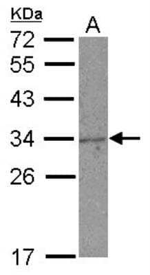 Western Blot: NKG2A/CD159a/KLRC1 Antibody [NBP2-17084]