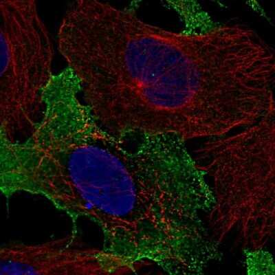 Immunocytochemistry/ Immunofluorescence: NKG2C/CD159c/KLRC2 Antibody [NBP2-58380]