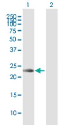 Western Blot: NKG2C/CD159c/KLRC2 Antibody [H00003822-B01P]