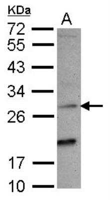 Western Blot: NKG2C/CD159c/KLRC2 Antibody [NBP2-17085]