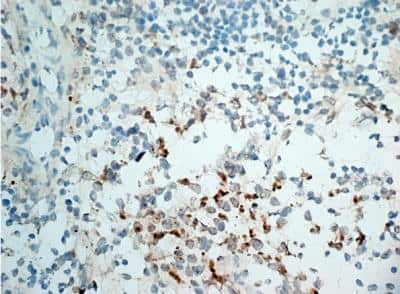 Immunohistochemistry-Frozen: NKG2D/CD314 Antibody (1D11) - Low Endotoxin, Azide and BSA Free [NB100-65956]