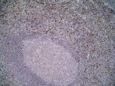 Immunohistochemistry-Frozen: NKG2D/CD314 Antibody (1D11) - Low Endotoxin, Azide and BSA Free [NB100-65956]