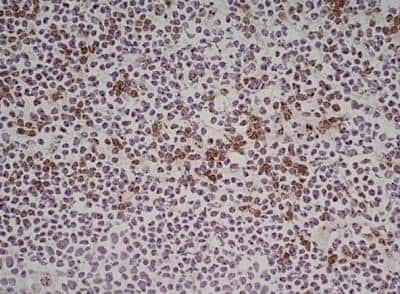 Immunohistochemistry-Frozen: NKG2D/CD314 Antibody (1D11) - Low Endotoxin, Azide and BSA Free [NB100-65956]