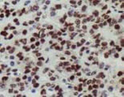 Immunohistochemistry-Paraffin: NKG2D/CD314 Antibody (1D11) - Low Endotoxin, Azide and BSA Free [NB100-65956]