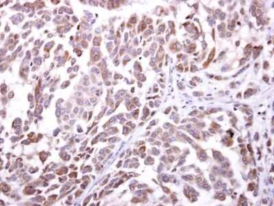 Immunohistochemistry-Paraffin: NKG2D/CD314 Antibody [NBP2-43645]