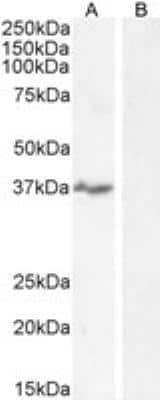 Western Blot: NKG2D/CD314 Antibody [NB100-1891]