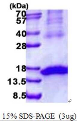 SDS-PAGE: Recombinant Human NKG2D/CD314 His Protein [NBP2-23173]