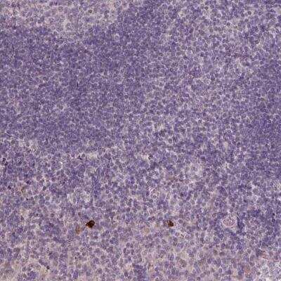 Immunohistochemistry: NKG2E/KLRC3 Antibody [NBP2-46867]