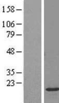 Western Blot: NKG7 Overexpression Lysate [NBL1-13654]