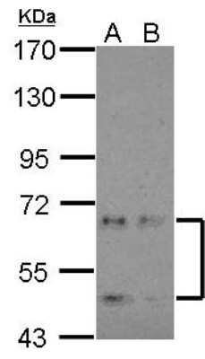 Western Blot: NKIAMRE Antibody [NBP2-19544]