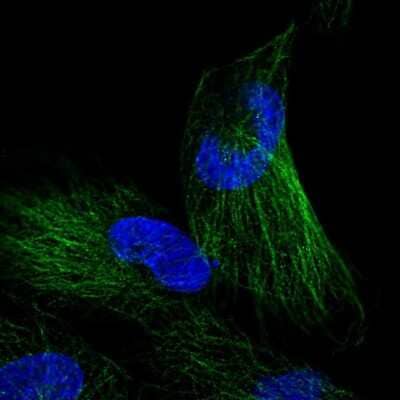 Immunocytochemistry/ Immunofluorescence: NKIRAS1 Antibody [NBP2-56399]