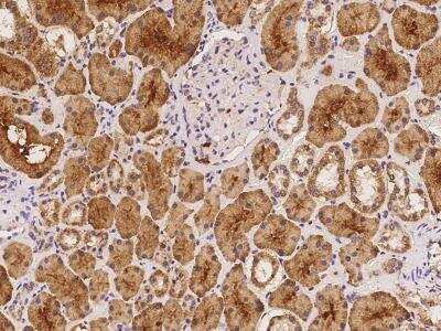 Immunohistochemistry-Paraffin: NKIRAS1 Antibody [NBP3-06173]