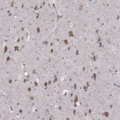 Immunohistochemistry-Paraffin: NKIRAS1 Antibody [NBP3-17198]