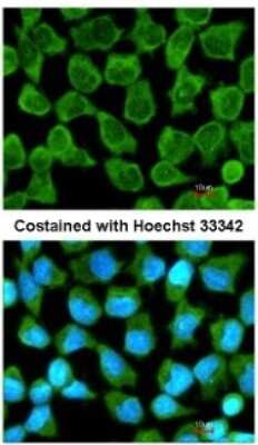 Immunocytochemistry/ Immunofluorescence: NKIRAS2 Antibody [NBP1-31696]