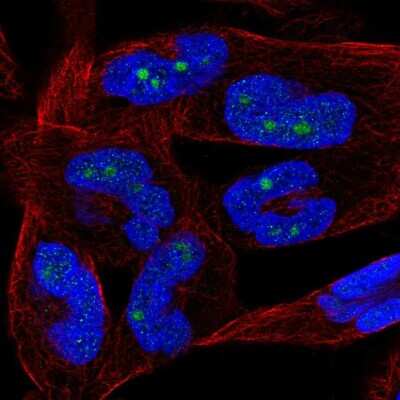 Immunocytochemistry/ Immunofluorescence: NKIRAS2 Antibody [NBP2-56207]