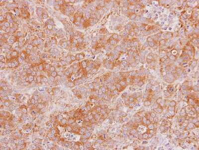 Immunohistochemistry-Paraffin: NKIRAS2 Antibody [NBP2-19545]