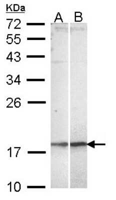 Western Blot: NKIRAS2 Antibody [NBP1-31696]