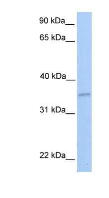 Western Blot: NKIRAS2 Antibody [NBP1-58925]