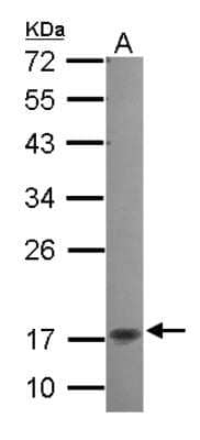 Western Blot: NKIRAS2 Antibody [NBP2-19545]