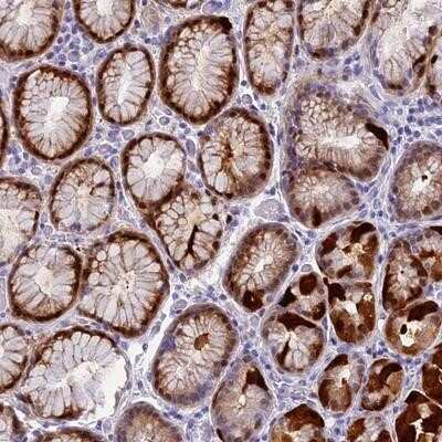 Immunohistochemistry-Paraffin: NKPD1 Antibody [NBP1-93854]