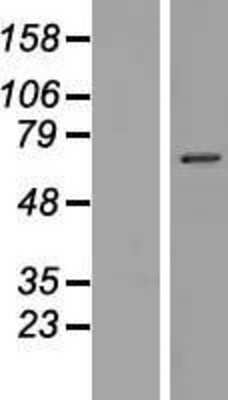 Western Blot: NKPD1 Overexpression Lysate [NBP2-04695]