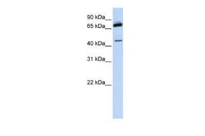 Western Blot: NKRF Antibody [NBP3-10499]