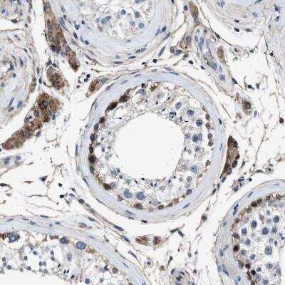 Immunohistochemistry-Paraffin: NKTR Antibody [NBP1-82459]