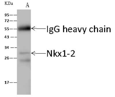 Immunoprecipitation: NKX1-2 Antibody [NBP2-99300]