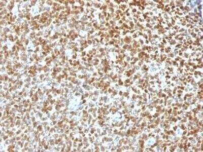 Immunohistochemistry-Paraffin: NKX2.2 Antibody (NX2/1422R) - Azide and BSA Free [NBP3-11619]