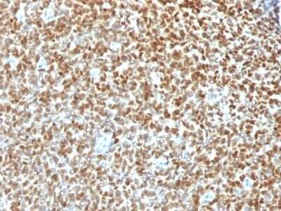 Immunohistochemistry-Paraffin: NKX2.2 Antibody (NX2/1422R) [NBP2-53208]