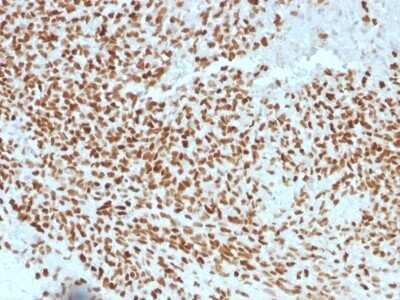 Immunohistochemistry-Paraffin: NKX2.2 Antibody (NX2/1523) - Azide and BSA Free [NBP2-54328]