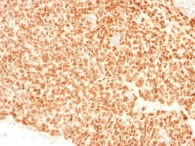 Immunohistochemistry-Paraffin: NKX2.2 Antibody (NX2/1523) - Azide and BSA Free [NBP2-54328]