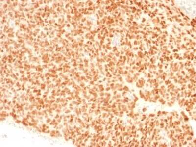 Immunohistochemistry-Paraffin: NKX2.2 Antibody (NX2/1523) [NBP2-53200]