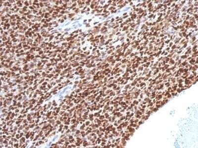 Immunohistochemistry-Paraffin: NKX2.2 Antibody (NX2/1524) - Azide and BSA Free [NBP2-54323]