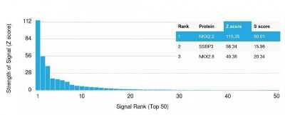 Protein Array: NKX2.2 Antibody (NX2/1524) [NBP2-53207]