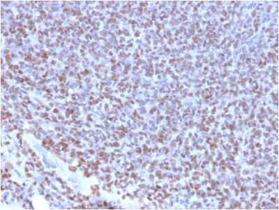 Immunohistochemistry-Paraffin: NKX2.2 Antibody (NX2/2198R) - Azide and BSA Free [NBP3-08568]