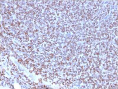 Immunohistochemistry-Paraffin: NKX2.2 Antibody (NX2/2198R) [NBP3-07410]