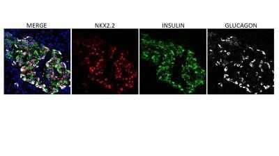 Immunohistochemistry-Frozen: NKX2.2 Antibody (NX2/294) - Azide and BSA Free [NBP2-33058]