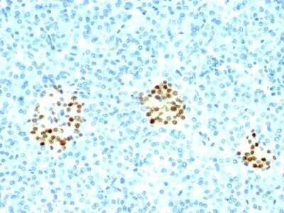 Immunohistochemistry-Paraffin: NKX2.2 Antibody (NX2/294) - IHC-Prediluted [NBP2-45154]