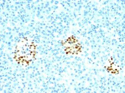 Immunohistochemistry-Paraffin: NKX2.2 Antibody (NX2/294) [NBP2-29432]