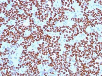 Immunohistochemistry-Paraffin: NKX2.2 Antibody (NX2/294) [NBP2-29432]