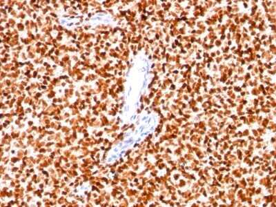 Immunohistochemistry-Paraffin: NKX2.2 Antibody (SPM564) - Azide and BSA Free [NBP2-34799]