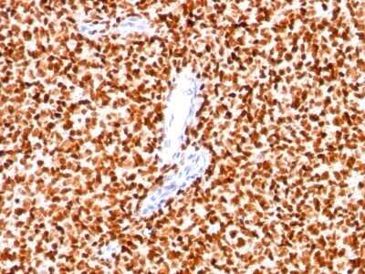 Immunohistochemistry-Paraffin: NKX2.2 Antibody (SPM564) - IHC-Prediluted [NBP2-45155]