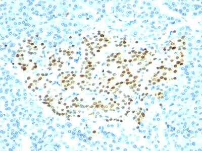 Immunohistochemistry-Paraffin: NKX2.2 Antibody (SPM564) [NBP2-32884]