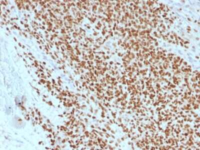 Immunohistochemistry-Paraffin: NKX2.2 Antibody (rNX2/1523) - Azide and BSA Free [NBP3-08567]