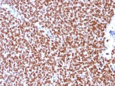 Immunohistochemistry-Paraffin: NKX2.2 Antibody (rNX2/294) - Azide and BSA Free [NBP2-54345]